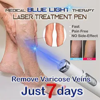 Bakım aracı Heath mavi ışık tedavisi varis tedavisi lazer kalem Yumuşak skar kırışıklık kaldırma tedavisi akne lazer kalem masaj